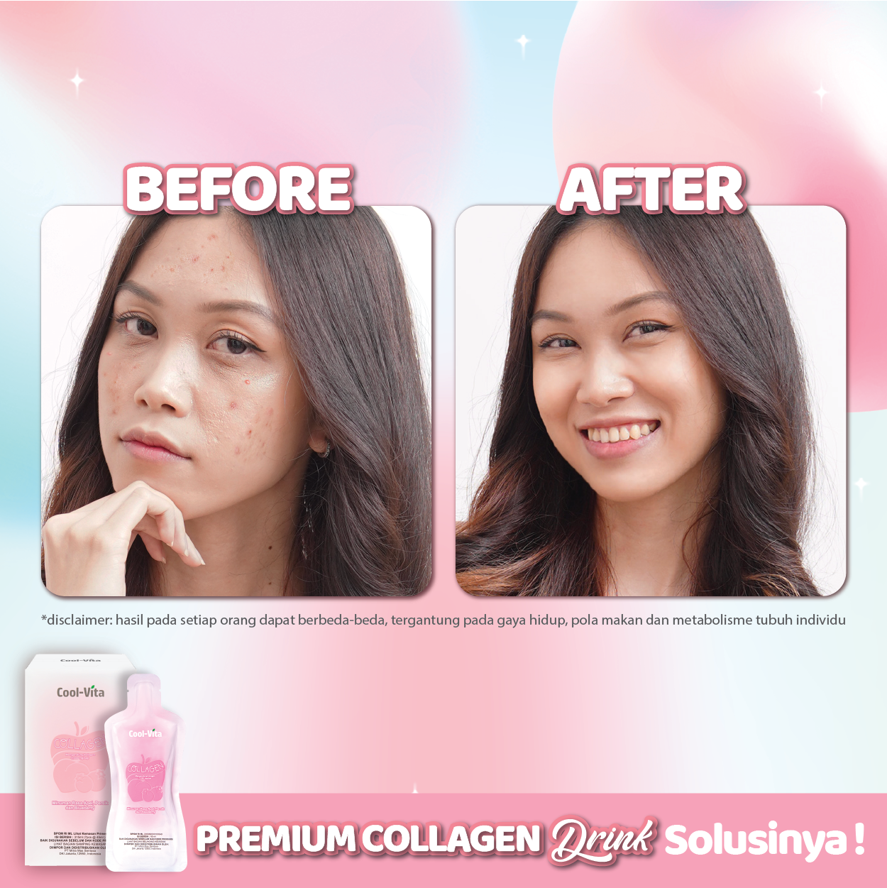 [10 Hari] Collagen Premium Langsung Minum 3000mg 3 Box